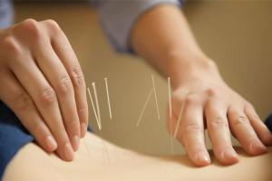 Phòng khám châm cứu tốt nhất Hà Nội