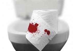 Nguyên nhân và cách điều trị đại tiện ra máu
