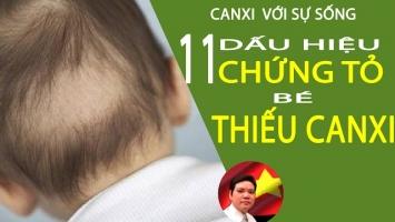 Dấu hiệu cho thấy trẻ thiếu canxi cha mẹ nên biết