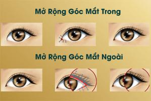 Địa chỉ mở góc mắt đẹp, uy tín nhất ở TP.HCM