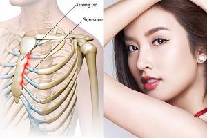 Địa chỉ nâng mũi sụn sườn đẹp, uy tín nhất tại TP.HCM