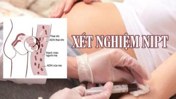 Địa chỉ xét nghiệm NIPT tốt nhất Kiên Giang